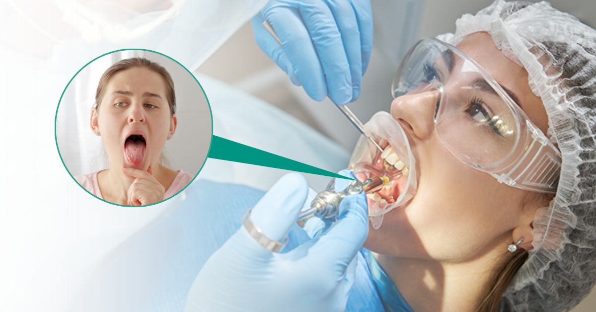 5 Conditions that Require Oral Cancer Treatment